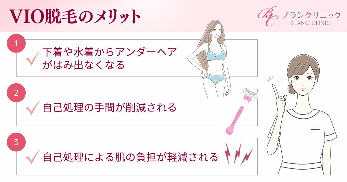VIO脱毛は恥ずかしくてもおすすめ!3つのメリットとは