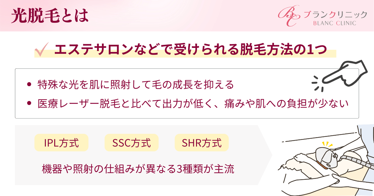 光脱毛とは？脱毛の仕組みと種類を解説