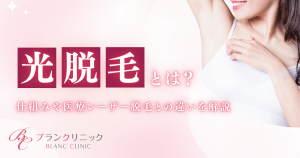 光脱毛とは？仕組みや種類、脱毛効果、医療レーザー脱毛との違い、エステサロン脱毛がおすすめな人を解説