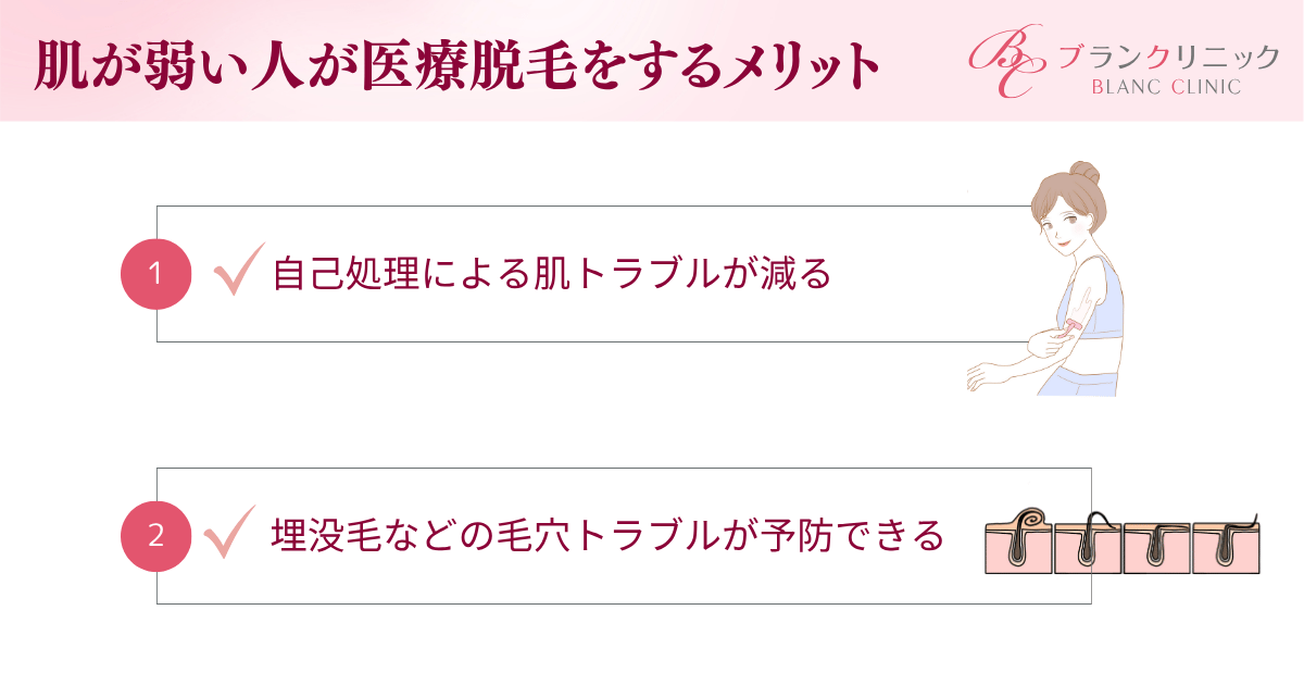 敏感肌・肌が弱い人が医療脱毛をする2つのメリット