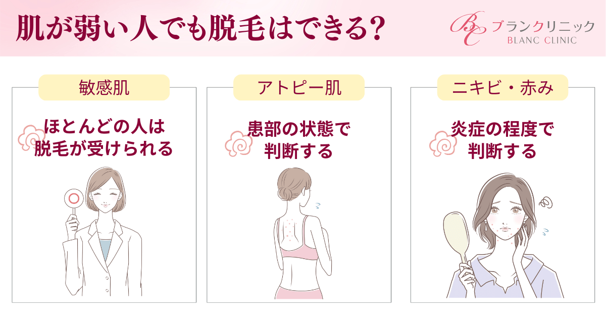 肌が弱い人でも脱毛はできる?3つの肌タイプで解説