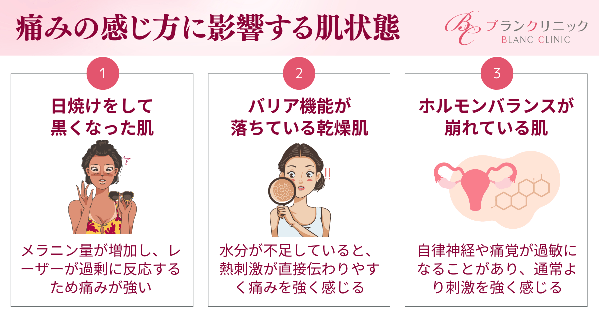医療レーザー脱毛の痛みの感じ方に影響する3つの肌状