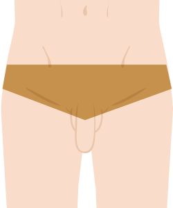 VIO脱毛（Vラインビキニライン骨盤上部より下）